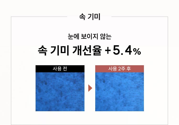 속 기미 / 눈에 보이지 않는 속 기미 개선율 + 5.4% / 사용전 > 사용 2주 후 비교