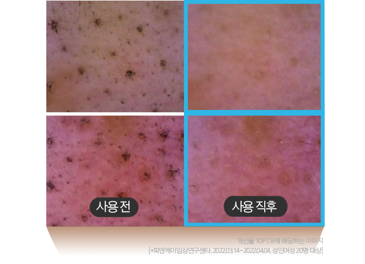 사용직후 개선율 TOP7, 8에 해당하는 이미지/[*피앤케이임상연구센타, 2022.03.14~2022.04.04, 성인여성 20명 대상] 