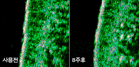 한율 백화고 기미단 크림 사용 4주 후와 사용 8주 후 비교. 피부 치밀도가 개선된 모습