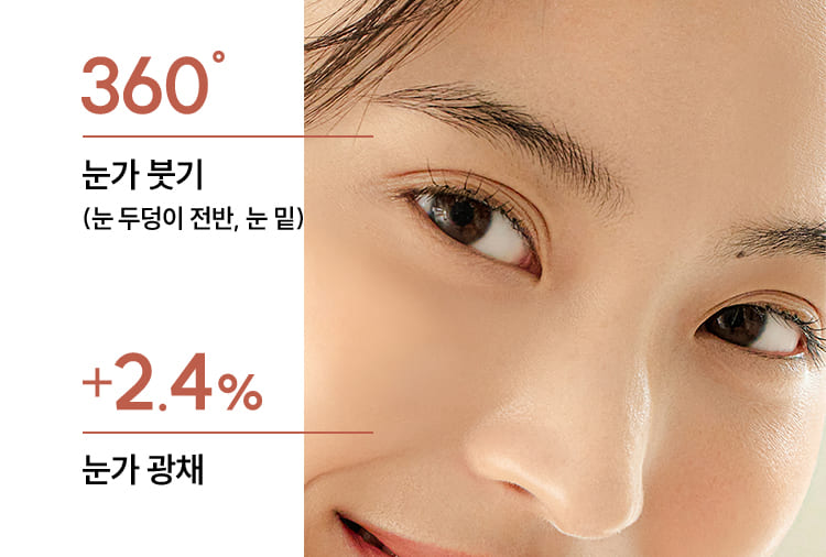 360° 눈가 붓기 (눈 두덩이 전반, 눈 밑) / +2.4% 눈가 광채