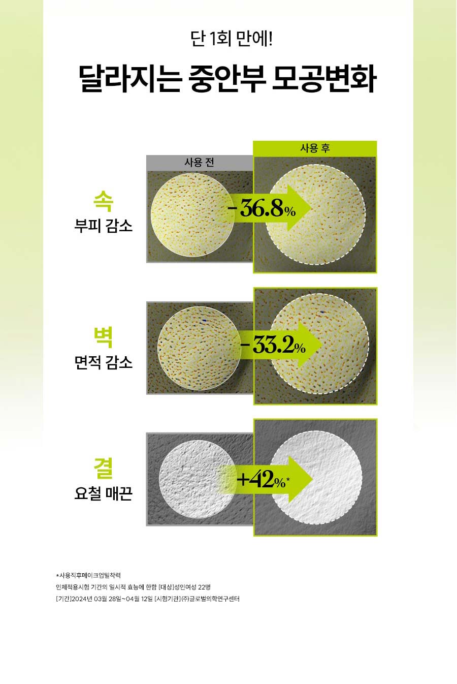 단 1회 만에! 달라지는 중안부 모공변화