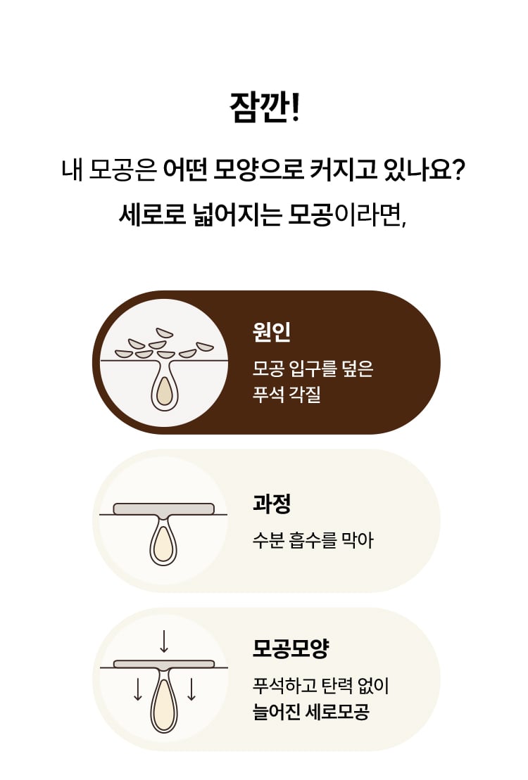 잠깐! 내 모공은 어떤 모양으로 커지고 있나요? 세로로 넓어지는 모공이라면,