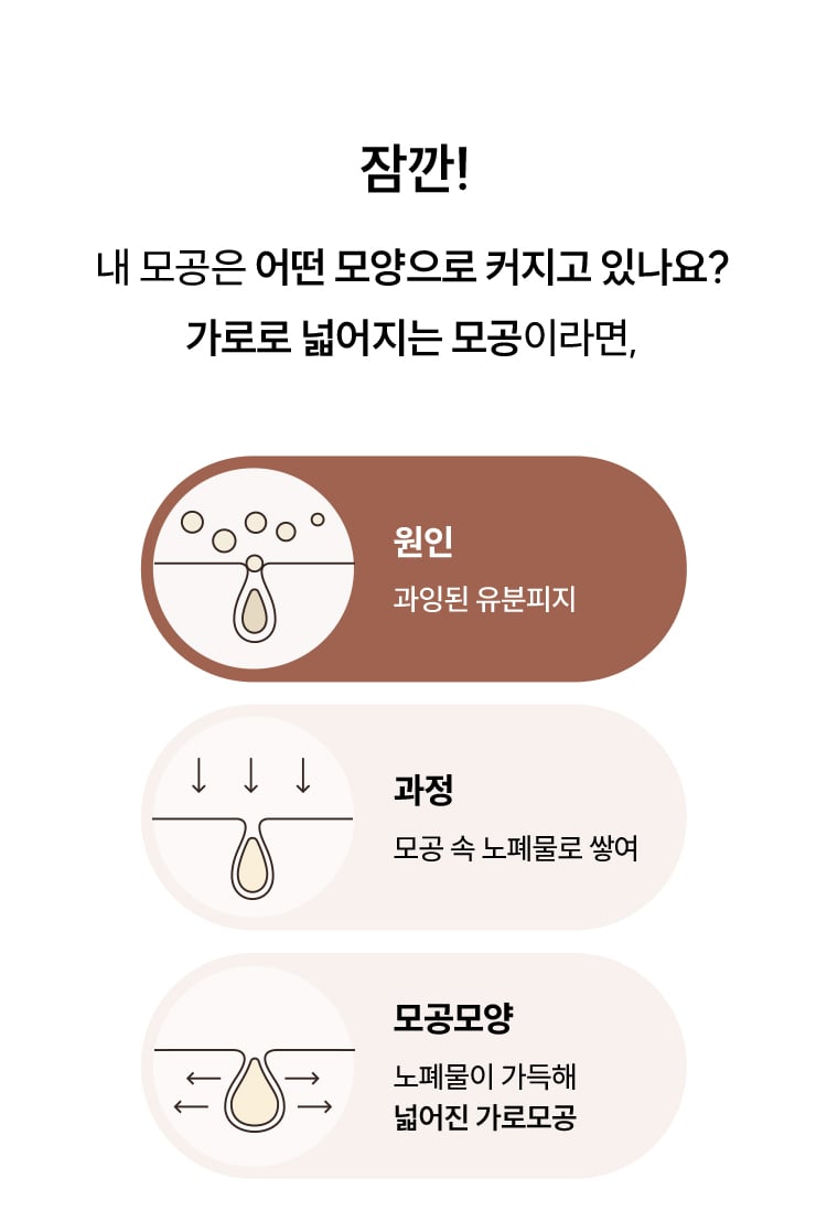 잠깐! 내 모공은 어떤 모양으로 커지고 있나요? 가로로 넓어지는 모공이라면,