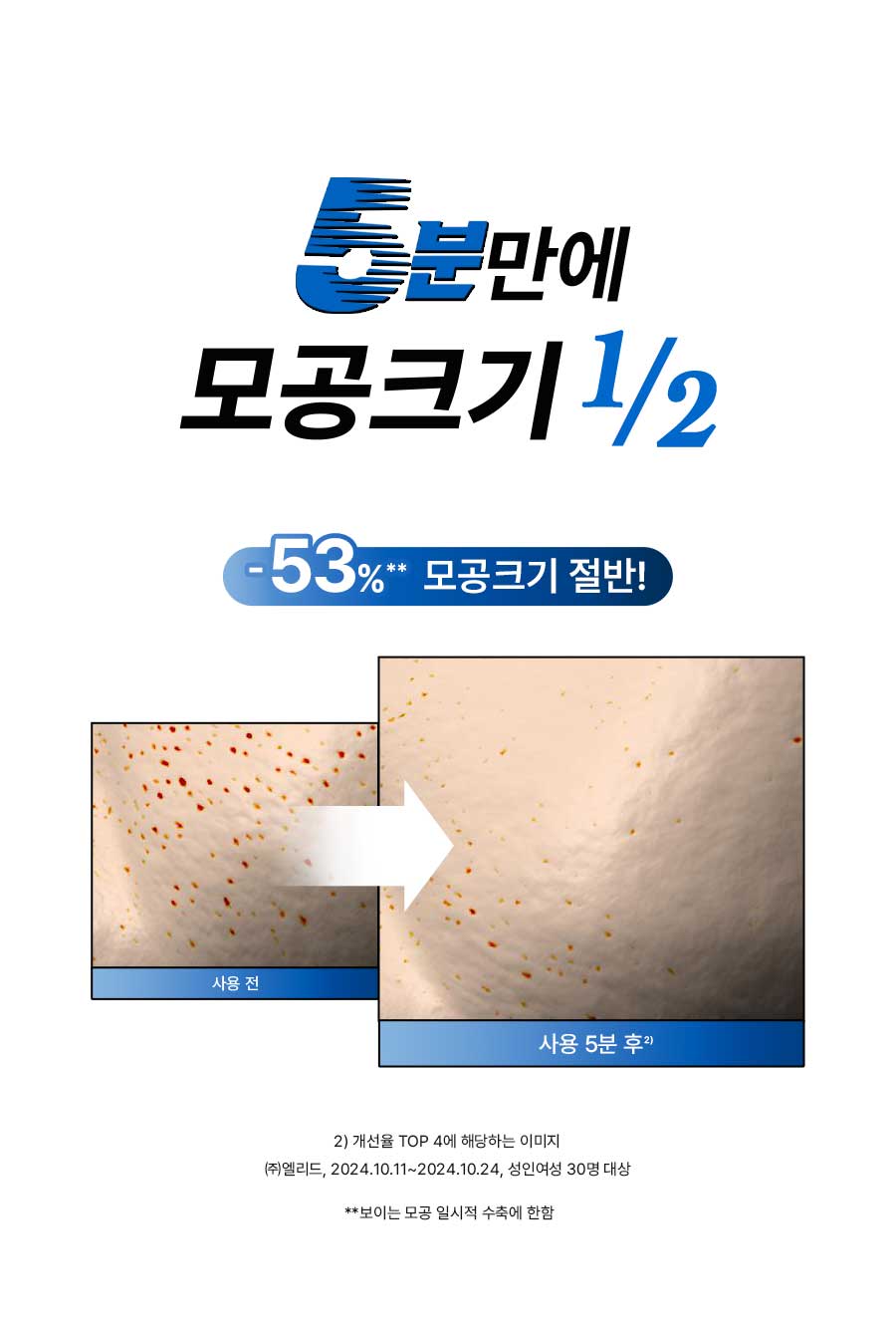 5분만에 모공크기1/2 -53% 모공크기 절반!