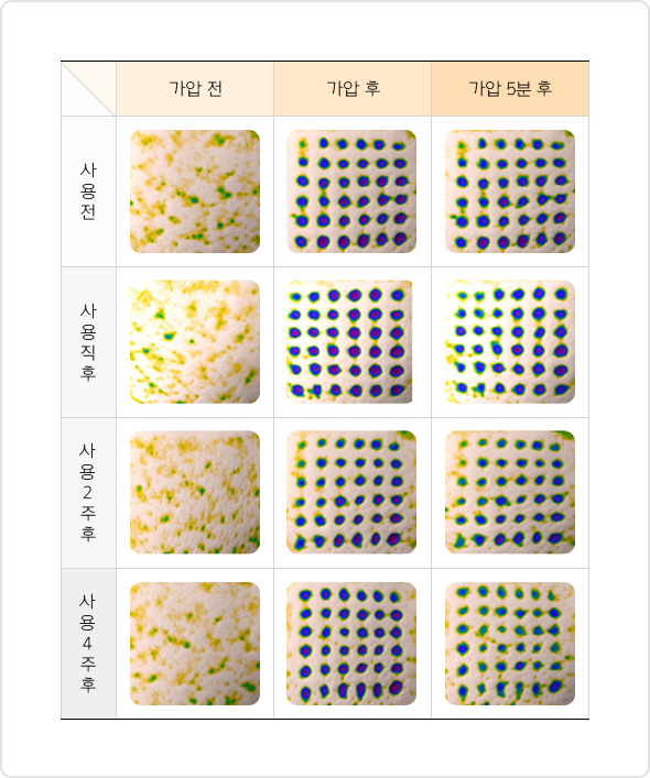 눌린 피부 완화 비교 이미지