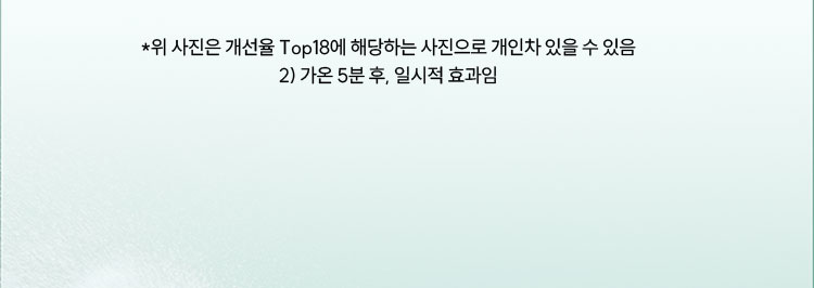 *위 사진은 개선율 Top18에 해당하는 사진으로 개인차 있을 수 있음
2) 가온 5분 후, 일시적 효과임