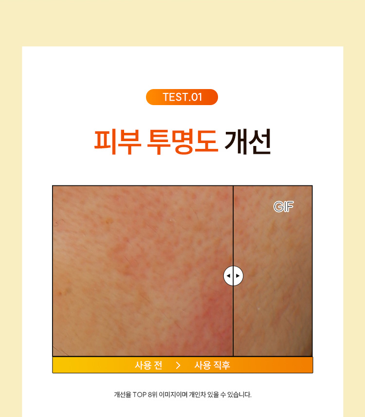 TEST.01 묵은각질 개선 : 개선율 TOP 8위 이미지이며 개인차 있을 수 있습니다.