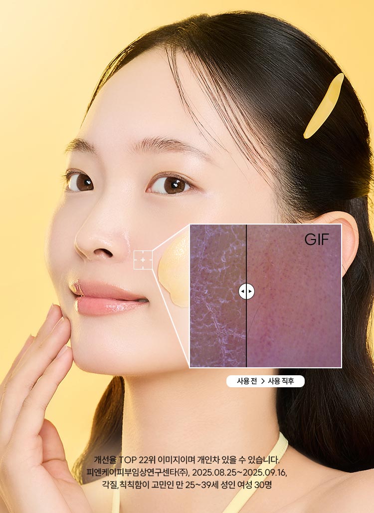 사용전과 사용직후 피부 상태 비교, 개선율 TOP 22위 이미지이며 개인차 있을 수 있습니다. 피엔케이피부임상연구센타(주), 2025.08.25~2025.09.16 각질, 칙칙함이 고민인 만 25~39세 여성 30명