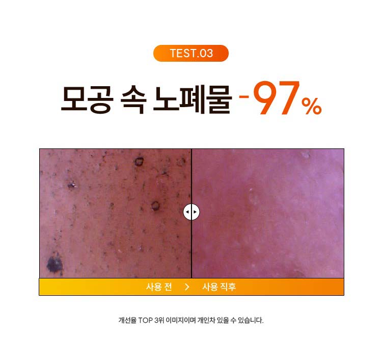 TEST.03 모공 속 노폐물 -97% 제거: 개선율 TOP 3위 이미지이며 개인차 있을 수 있습니다.