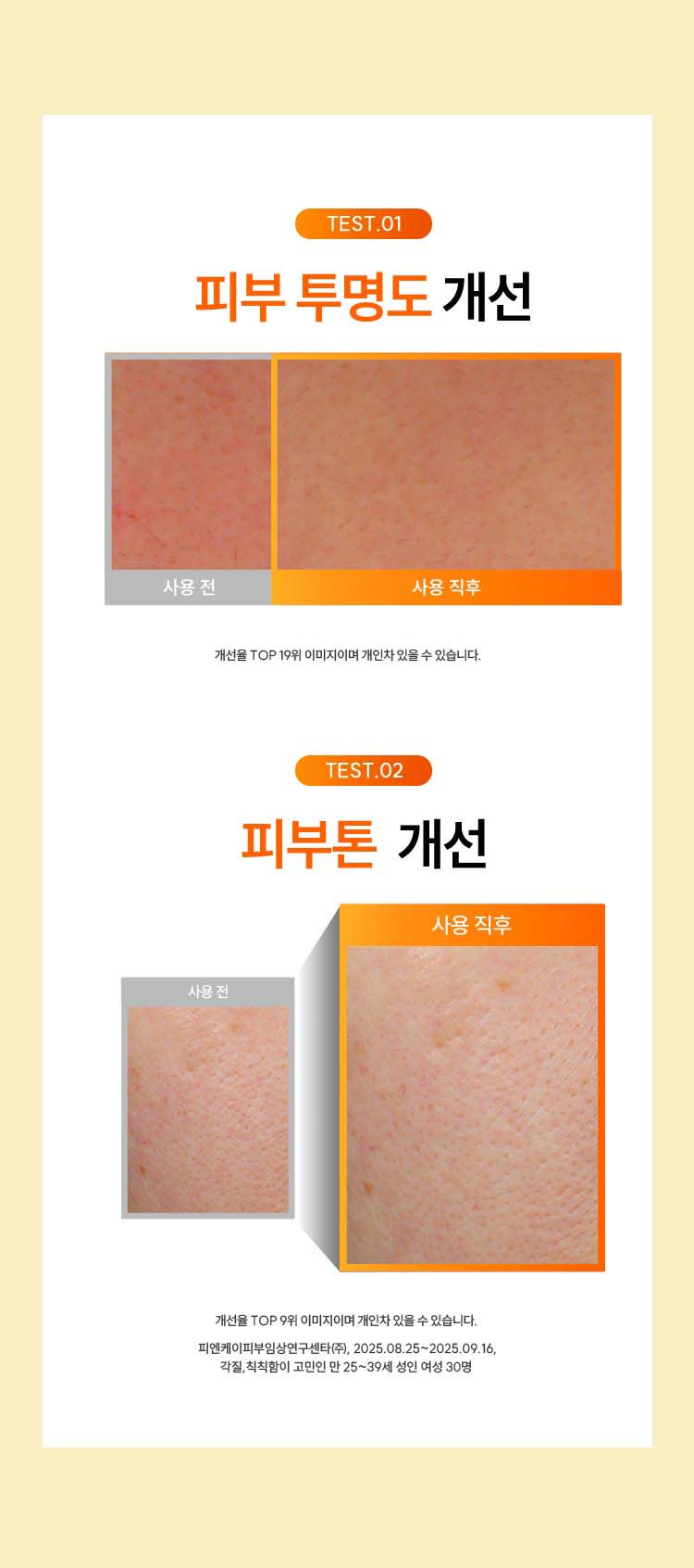 TEST.01 피부 투명도 개선 : 개선율 TOP 19위 이미지이며 개인차 있을 수 있습니다. TEST.02 피부 투명도 개선 : 개선율 TOP 9위 이미지이며 개인차 있을 수 있습니다. 피엔케이피부임상연구센타(주), 2025.08.25~2025.09.16 블랙&화이트헤드, 묵은각질이 고민인 만 25~39세 여성 30명
