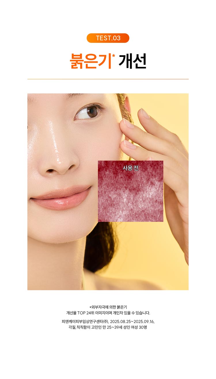 TEST.03 붉은기*개선 / *외부자극에 의한 붉은기 개선율 / TOP 24위 이미지이며 개인차 있을 수 있습니다. 피엔케이피부임상연구센타(주), 2025.08.25~2025.09.16 블랙&화이트헤드, 묵은각질이 고민인 만 25~39세 여성 30명