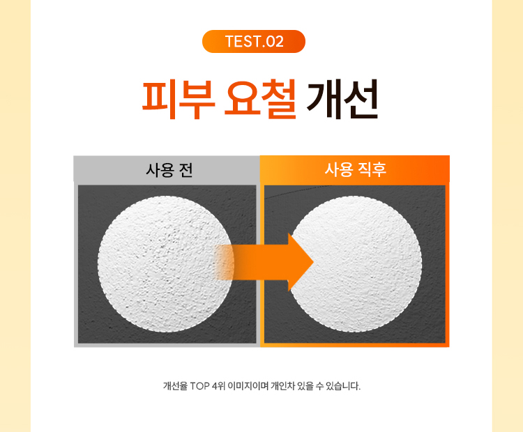 TEST.02 사용전후 피부요철 개선 : 개선율 TOP 4위 이미지이며 개인차 있을 수 있습니다.