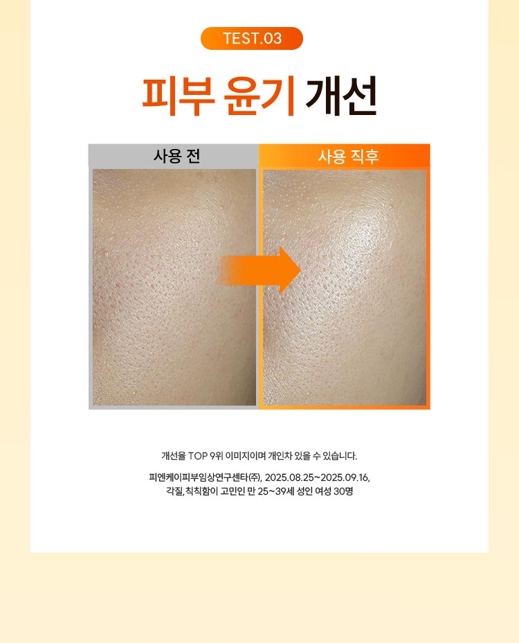 TEST.03 사용전후 피부 윤기 개선 : 개선율 TOP 9위 이미지이며 개인차 있을 수 있습니다. 피엔케이피부임상연구센타(주), 2025.08.25~2025.09.16 블랙&화이트헤드, 묵은각질이 고민인 만 25~39세 여성 30명