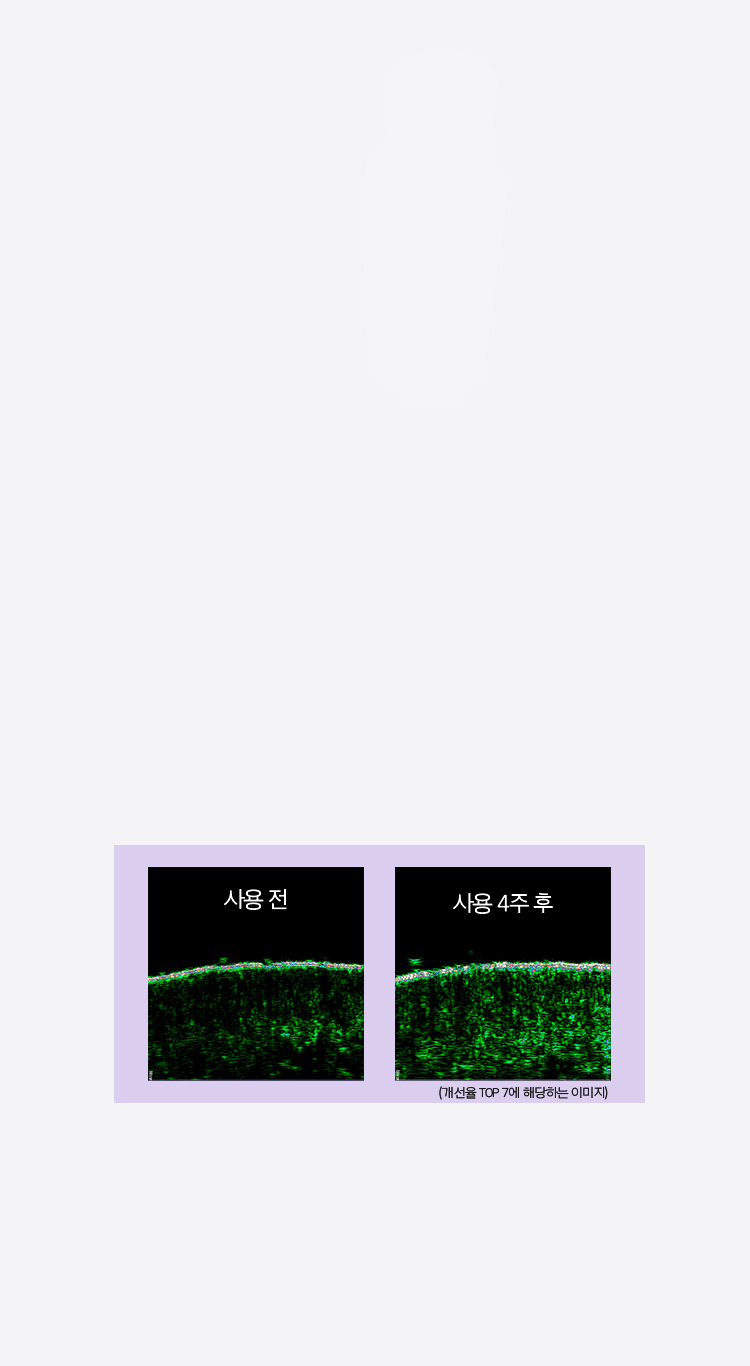 개선율 TOP 7에 해당하는 이미지
