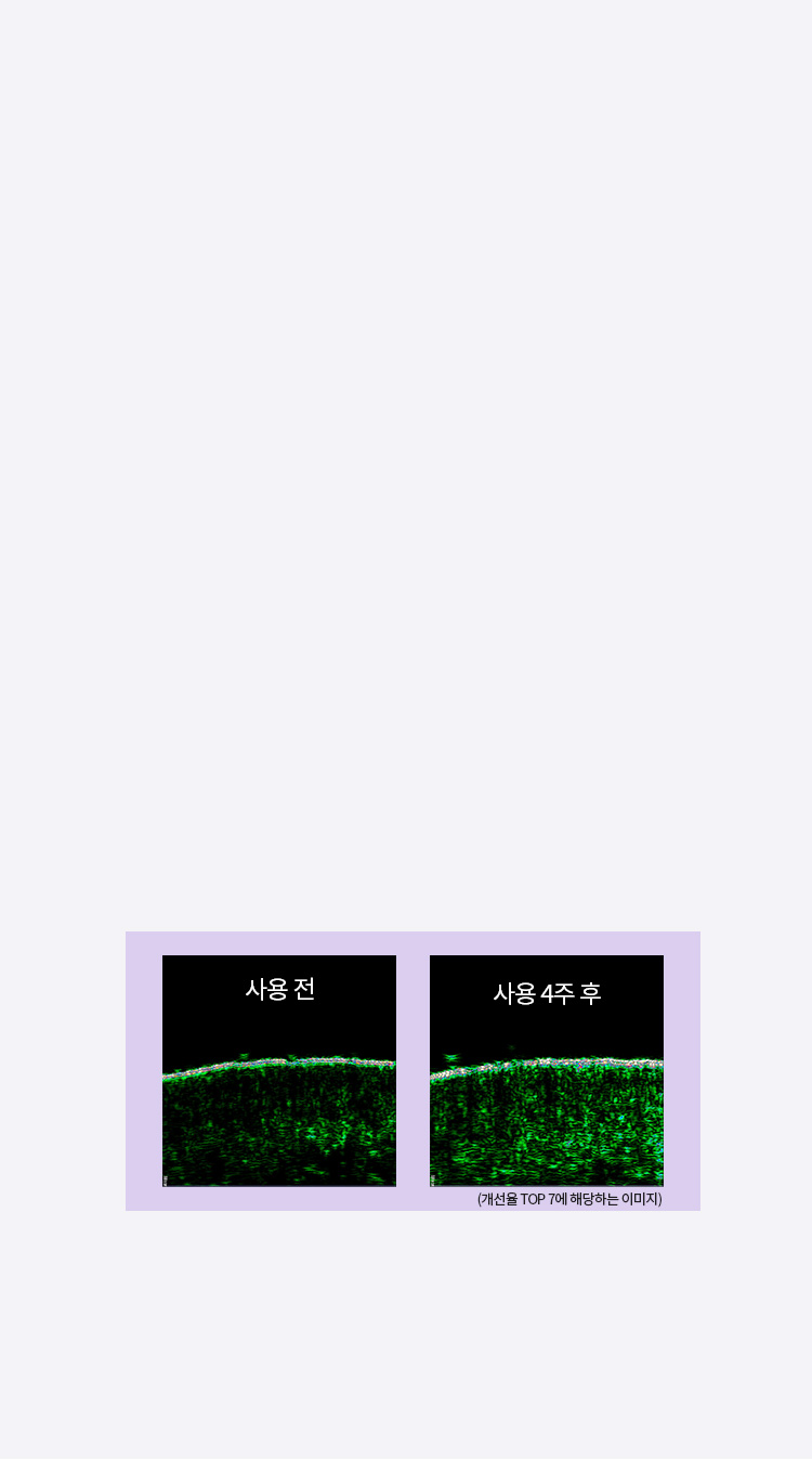 개선율 TOP 7에 해당하는 이미지