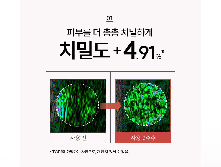 01 피부를 더 촘촘 치밀하게 치밀도 +4.91% 사용 전 > 사용 2주후 *TOP1에 해당하는 사진으로, 개인 차 있을 수 있음