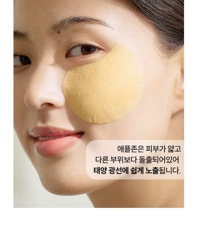 애플존은 피부가 얇고 다른 부위보다 돌출되어있어 태양 광선에 쉽게 노출됩니다.